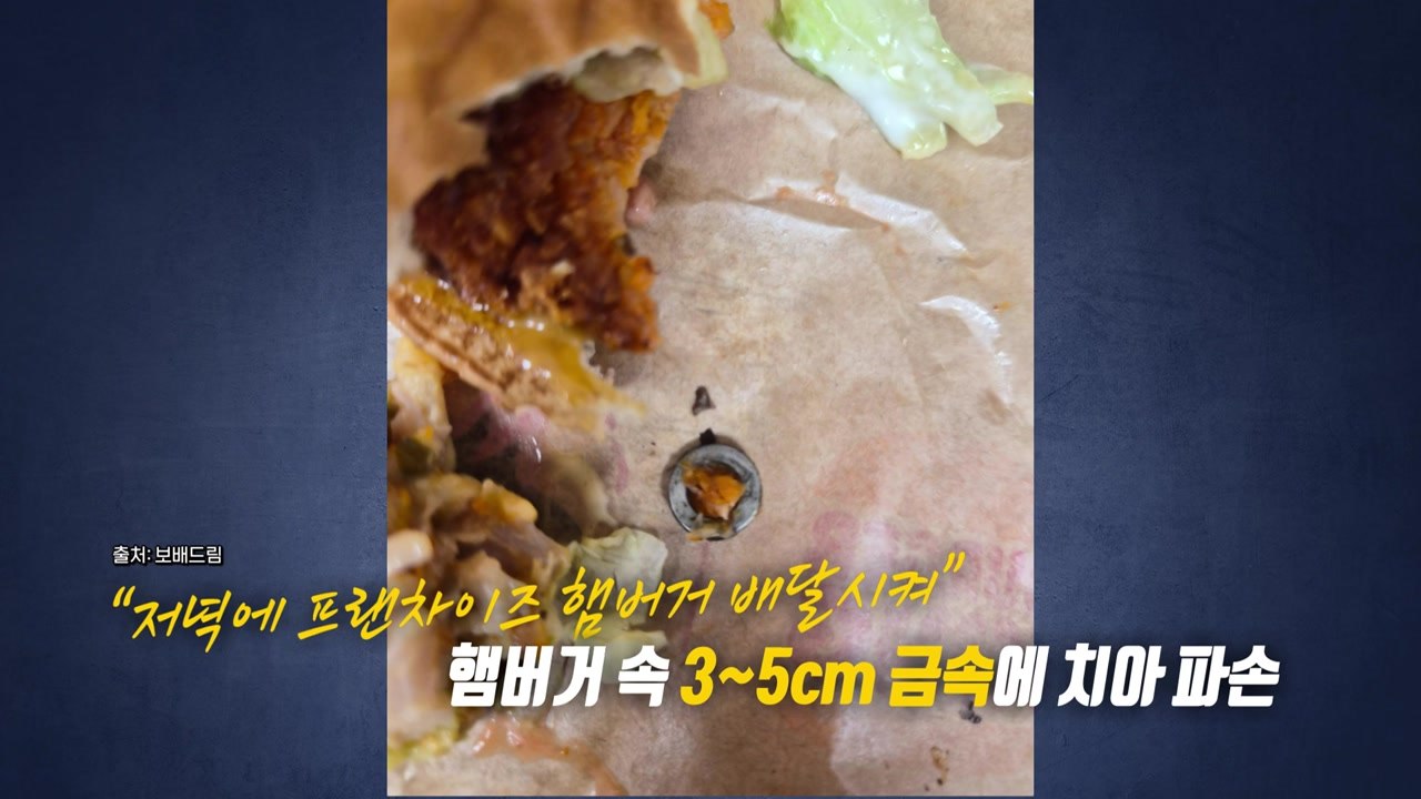 "햄버거 먹다 금속에 치아 부러져"...갑론을박에 사실은? [앵커리포트] / YTN
