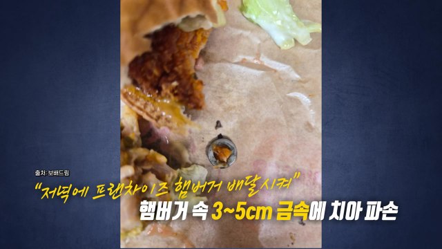 햄버거 먹다 금속에 치아 부러져 ...갑론을박에 사실은? [앵커리포트] / YTN