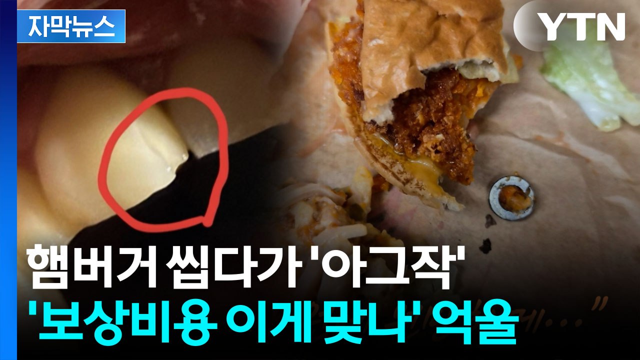 [자막뉴스]프랜차이즈 햄버거서 나온 '금속'...부러진 이빨 두고 갑론을박 / YTN