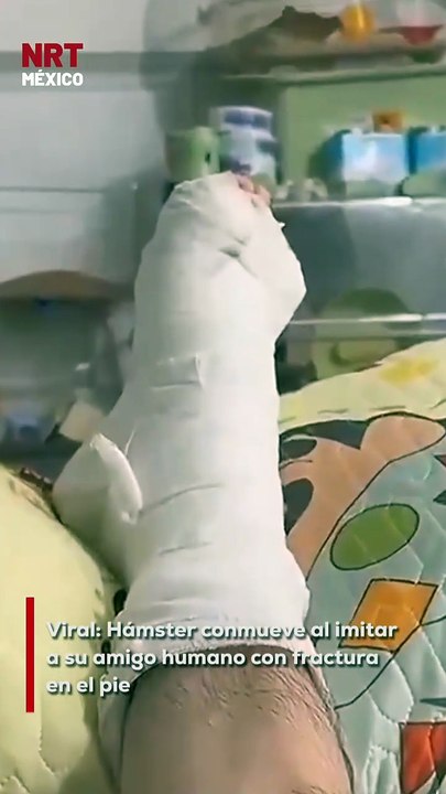 Un hámster se volvió viral al imitar con ternura a su dueño, quien recientemente sufrió una fractura en el pie. La adorable escena fue captada en video y ha derretido a miles en redes.