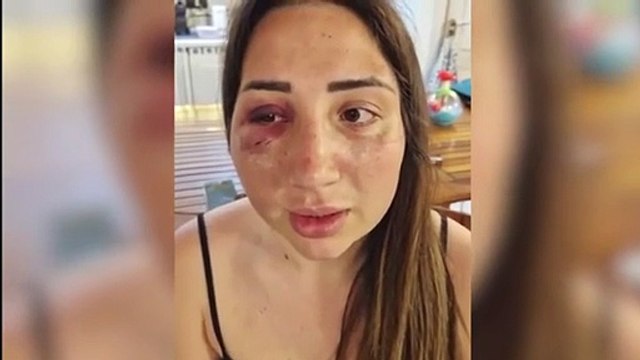 «Mi ha picchiata e voleva buttarmi di sotto»: il racconto di Gaia, vittima di violenza da parte dell'ex