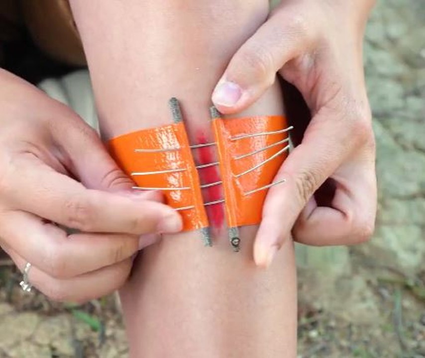 First Aid Hacks Everyone Should Know