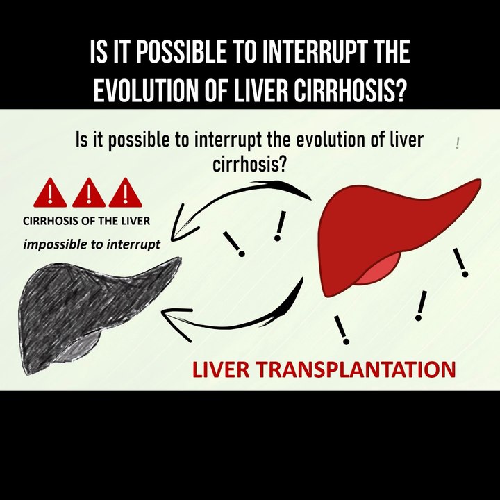 Is it possible to interrupt the evolution of liver cirrhosis?