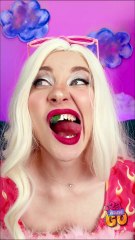 Trying to Act Normal While Picking Food From Your Teeth 🍽️😅