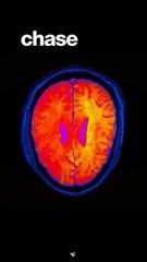 Rise & Inspire: How to Chase Your Real Dopamine ! You Must Know.