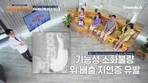 긴밀하게 연결되어 있는 위와 장, 소화장애를 방치하면 위장에 싱크홀이 생긴다?!