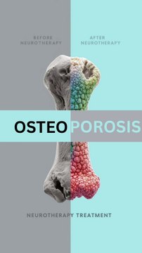 Signs & Symptoms of Osteoporosis You Shouldn’t Ignore /Ramesh Mane