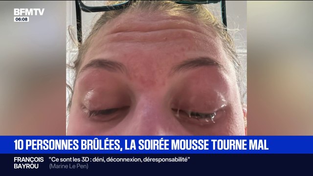 Victimes de brûlures aux yeux, dix jeunes hospitalisés après une soirée mousse dans un bar d'Argelès-sur-Mer