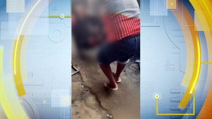 Idoso Atacado por Cão Misto de Pitbull em Depósito de Recicláveis em Recife: Estado de Saúde e Detalhes do Incidente