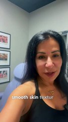 How Microneedling Helps with Scars and Skin Texture