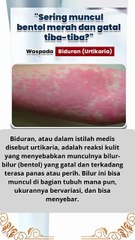 apa itu penyakit biduran dan fakta yang harus kita ketahui