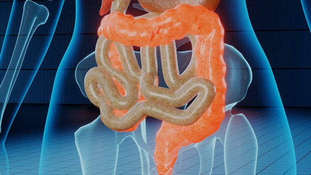 Colite ulcerosa, autorizzata la rimborsabilit? per etrasimod