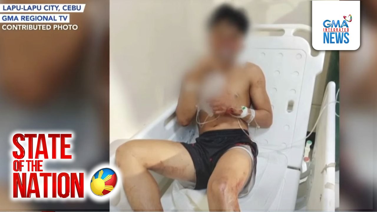 Estudyante, sugatan sa pananaksak na bunsod daw ng personal na galit | SONA