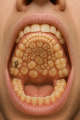 Extreme Dental Case That Left Experts Speechless