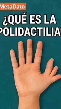 Polidactilia Más que 10 dedos - MetaDato (360p, h264) (1)