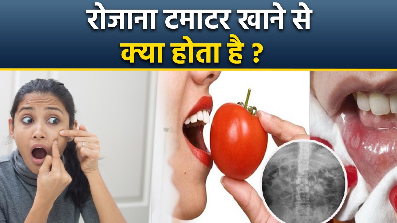 Roj Tamatar Khane Se Kya Hota Hai,टमाटर खाने के फायदे | खाने का सही तरीका | Boldsky