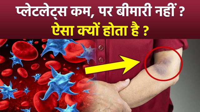 Low Platelet Count Causes: बीमारी के बिना प्लेटलेट्स कम होने का क्या कारण होता है, कितना होना चाहिए