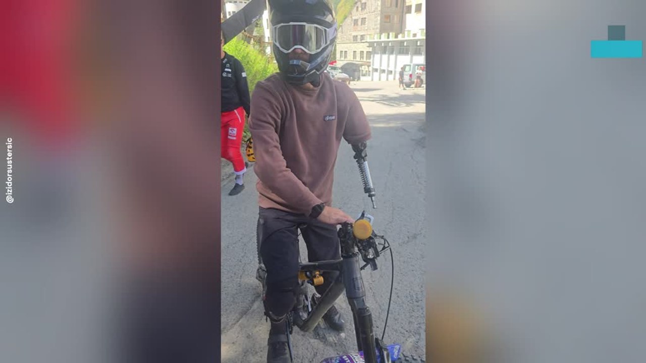 Rider Shows His Special Prostheic Arm