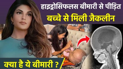 Jacqueline ने Hydrocephalus से पीड़ित बच्चे की सर्जरी का उठाया खर्च | Causes, Symptoms & Treatment..