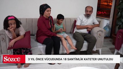 Salatalık yutunca rahatsızlandı; 3 yıl önce vücudunda 18 santimlik kateter unutulduğu ortaya çıktı