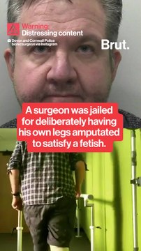 A surgeon amputated his own feet for his sexual fetish.