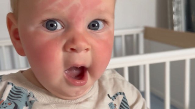 Baby wakes up from nap with a handprint stamped on his face