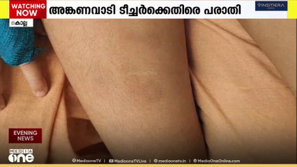 അക്ഷരം പഠിച്ചില്ല; കൊല്ലത്ത് നാലര വയസുകാരനെ അങ്കണവാടി ടീച്ചർ ക്രൂരമായി ഉപദ്രവിച്ചെന്ന് പരാതി