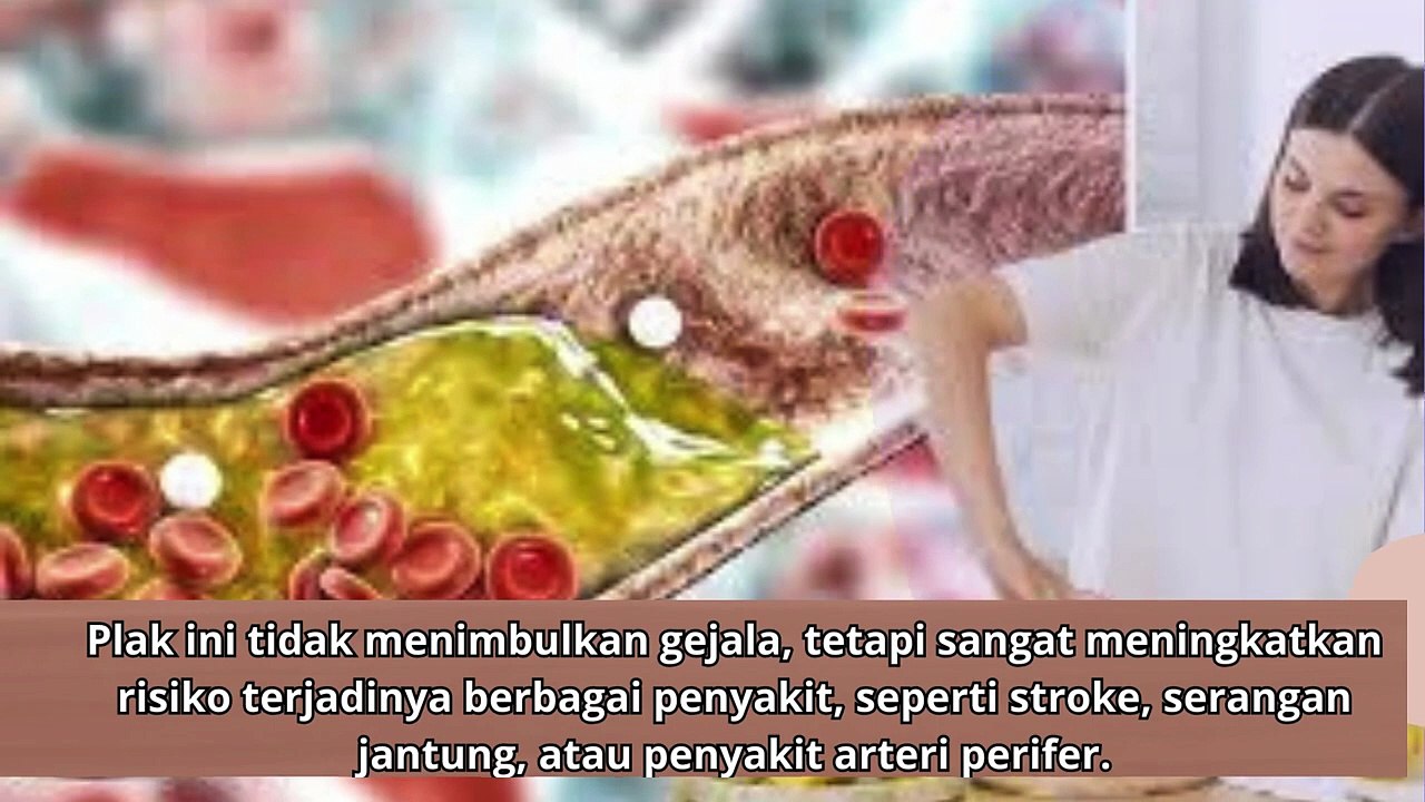 Jamu  yang Efektif Turunkan Kolesterol Jahat yang juga populer di Luar Negeri