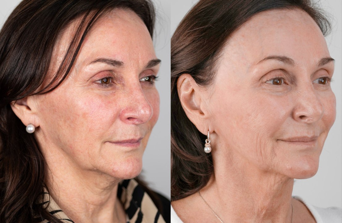Shirley Ballas is convinced she looks 20 years...