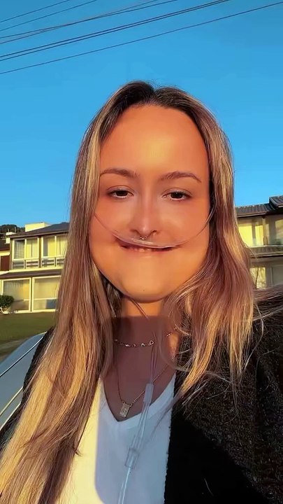 Manezinha com doença rara emociona e viraliza nas redes sociais