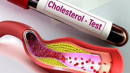 Healthy Lifestyle के बावजूद Cholesterol क्यों बढ़ता है?