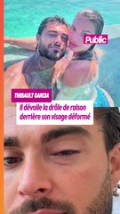 Thibault Garcia s’affiche le visage défiguré, la cause amuse les internautes