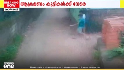 കുട്ടികൾക്ക് നേരെ തെരുവുനായ ആക്രമണം; പരിക്കേറ്റ കുട്ടി മെഡിക്കൽ കോളജിൽ ചികിത്സയിൽ