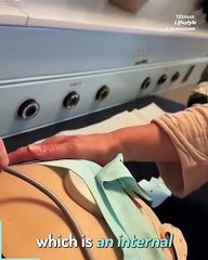 Doctors don't know how to get my baby out of me - or if I will survive labour 😭