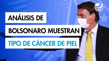 Análisis de Bolsonaro muestran un tipo precoz de cáncer de piel