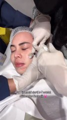 setelah skinbooster Nucleofill di ,kulit berasa lebih kenyal, sehat, full collagen bener-bener happy sama hasilnya, Special buat kalian, aku ada kode promo: GLOWLENNA bisa dipakai kalau mau treatment di @The Elshe Clinic , dapet potongan Rp200.000