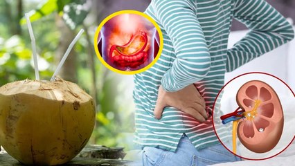 21 Dino Tak Nariyal Paani Peene Se Kya Hota Hai, नारियल पानी लगातार कितने दिन पीना चाहिए | Boldsky