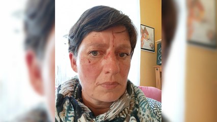 Dans la Manche, cette maman d'enfant autiste est au bord du gouffre