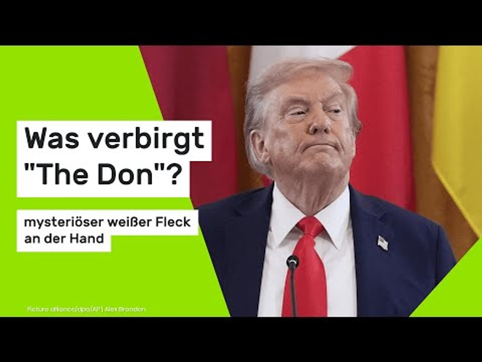 Donald Trump: Mit mysteriösem weißen Fleck an der Hand auf Schloss Windsor - was verbirgt 'The Don'?