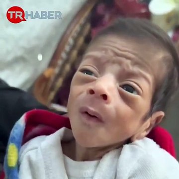 İkizini dumanda kaybetti, açlığa mahkûm edildi: Gazze'de 1 aylık Mohamed 1 kilonun altında