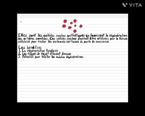 Une thérapie cellulaire pour traiter la perte de conscience