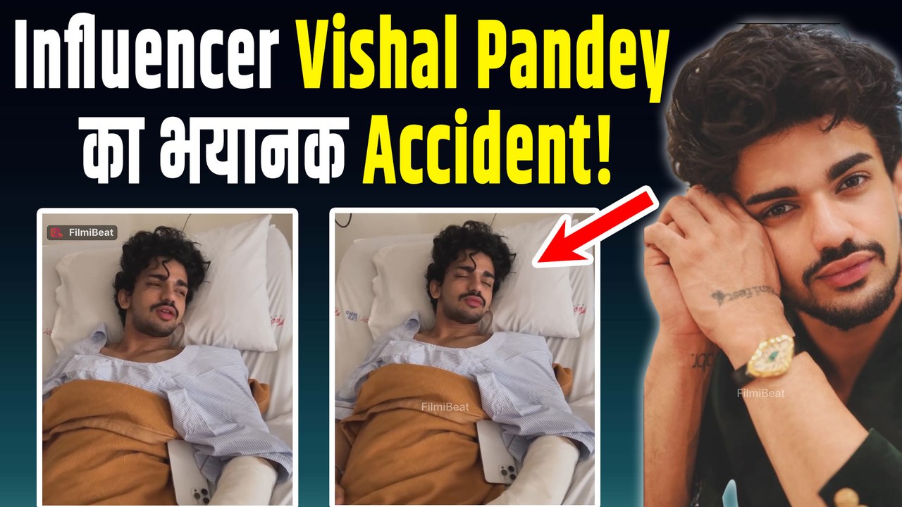 Bigg Boss OTT 3 Fame Vishal Pandey का खतरनाक Accident, हादसे में नसों में घुसे कांच के टुकड़े!
