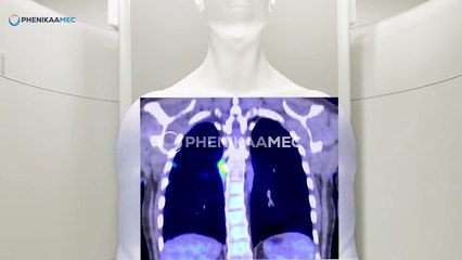 Các trường hợp dị tật tim bẩm sinh ở thai nhi dễ bị bỏ sót mẹ nên lưu ý