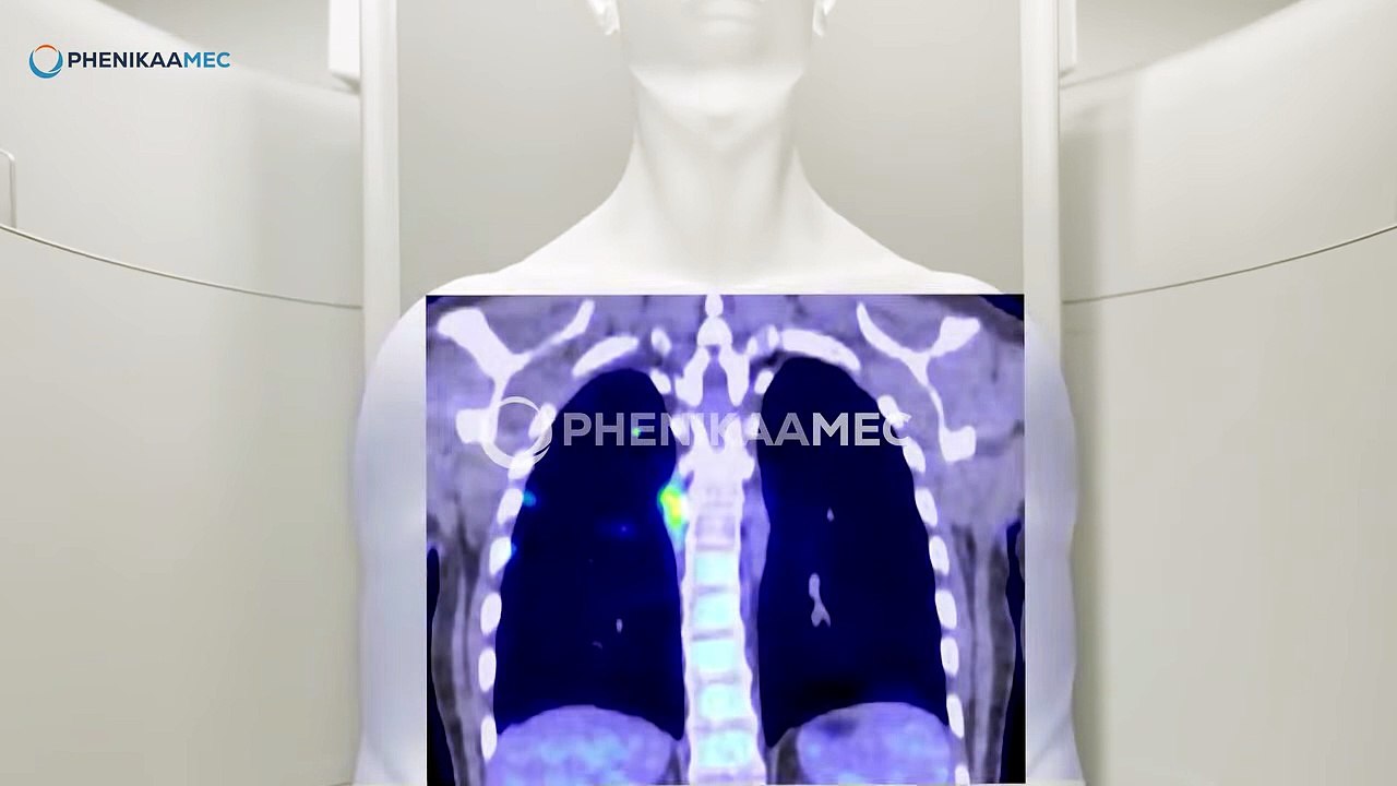 Các trường hợp dị tật tim bẩm sinh ở thai nhi dễ bị bỏ sót mẹ nên lưu ý