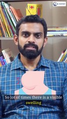 Thyroid cancer_ What are the symptoms _ Dr. Anand Subash _ Head & Neck Oncologist in Bangalore