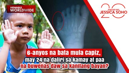 Bata, may 24 na daliri sa kamay at paa na buwenas daw sa kanilang bayan? | Kapuso Mo, Jessica Soho