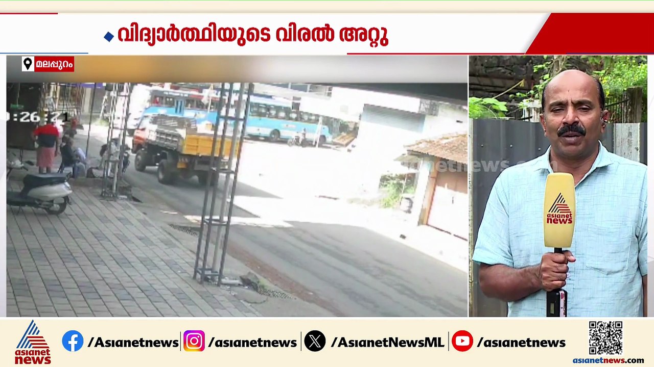 തിരൂരിൽ പ്രൈവറ്റ് ബസുകൾക്കിടയിൽ കൈ പെട്ട് വിദ്യാർത്ഥിയുടെ വിരൽ നഷ്ടപ്പെട്ടു
