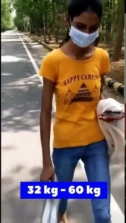 💪 رحلة زيادة الوزن: من 32 كجم إلى 60 كجم | قبل وبعد 💪 My Weight Gain Journey: 32 kg to 60 kg | Before & After