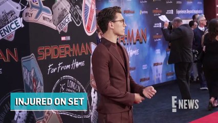 Tom Holland Suffers Head Injury While Filming Spider-Man Sequel _ E! News