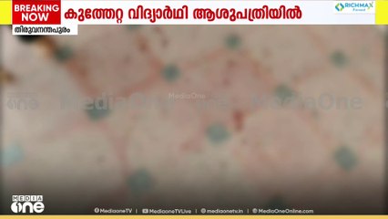 തിരുവനന്തപുരത്ത് വിദ്യാർത്ഥികൾ തമ്മിൽ സംഘർഷം: ഒരാൾക്ക് കുത്തേറ്റു